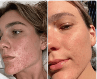 Clarexin Customer Reviews 1