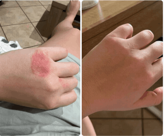 Clarexin Customer Reviews 2